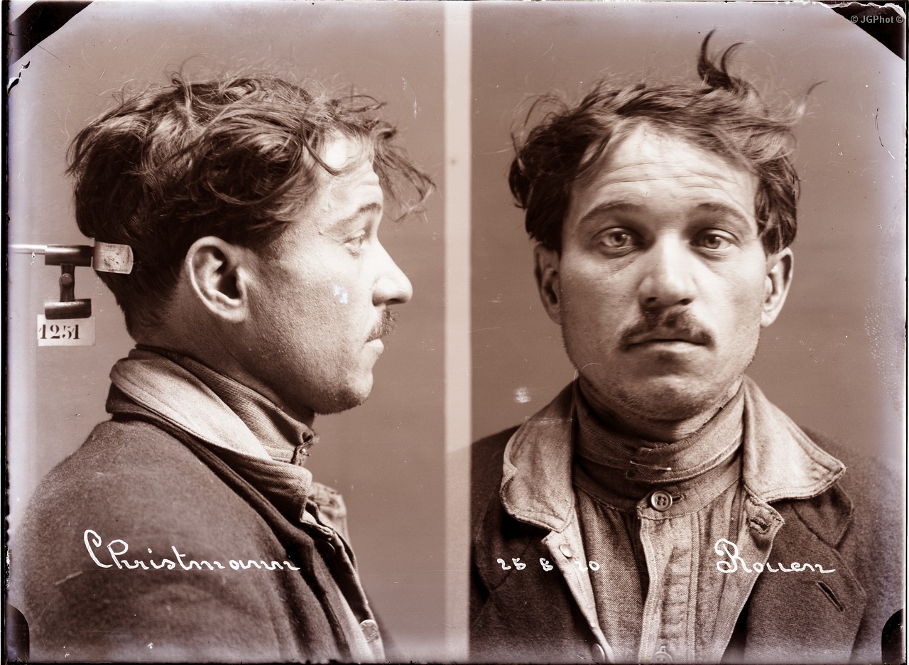 Bertillon