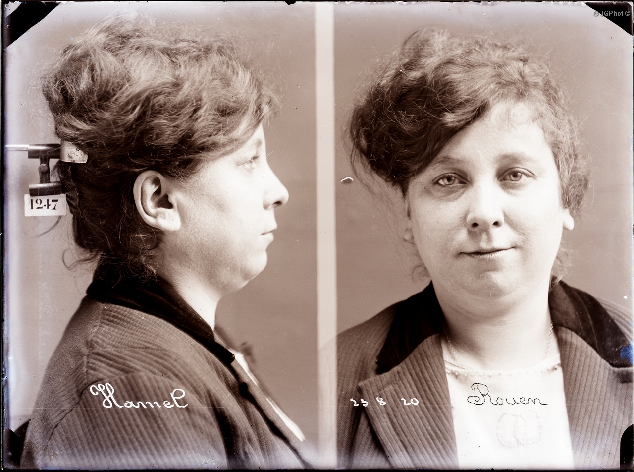 Bertillon
