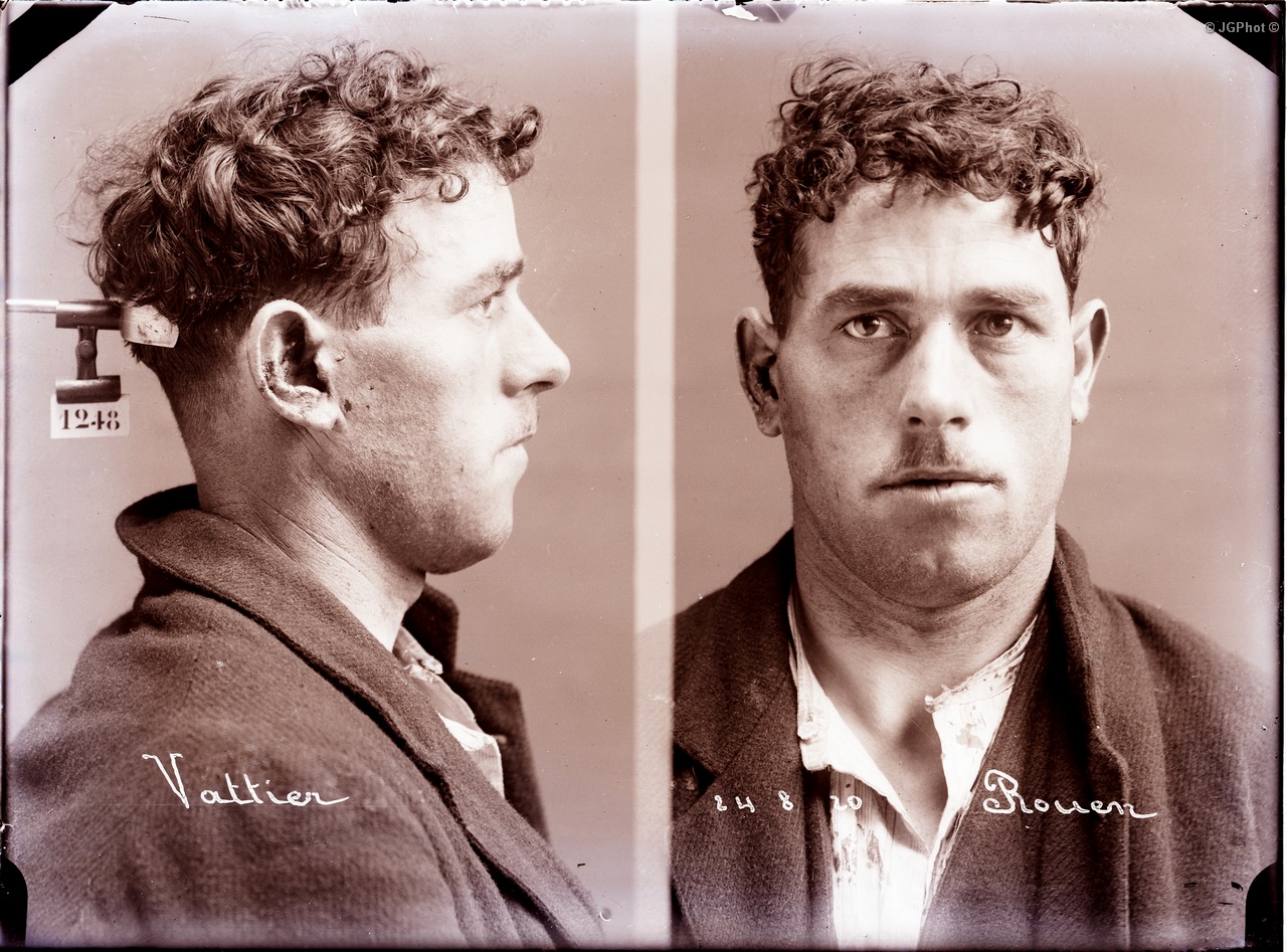 Bertillon